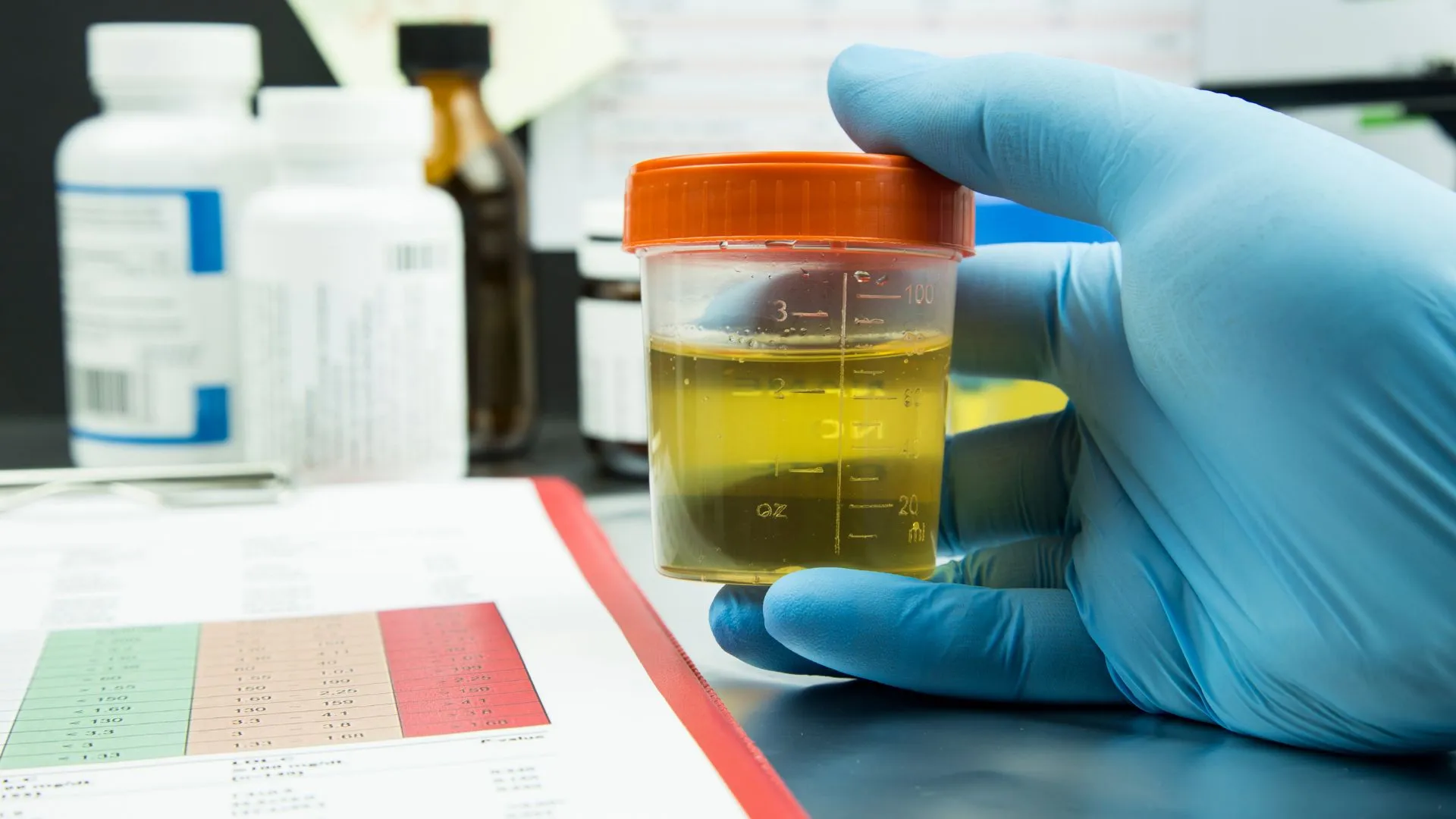 DOT Urine Test Facts You Need to Know