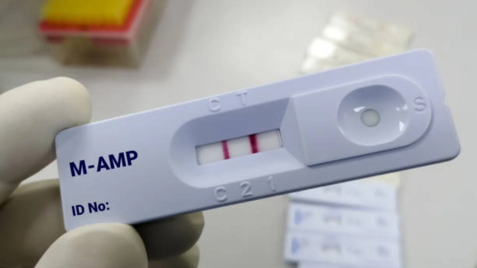 What is amp on a drug test?