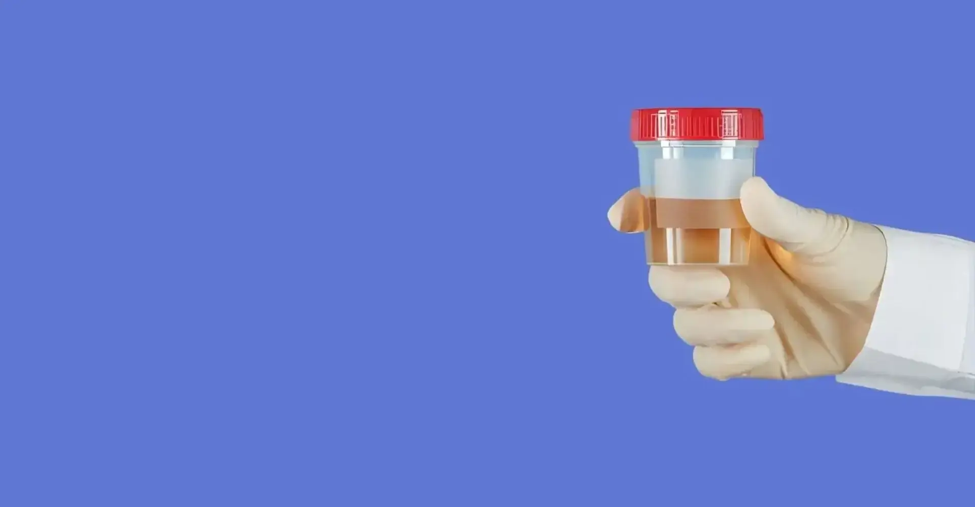 Urine & Hair Drug Test